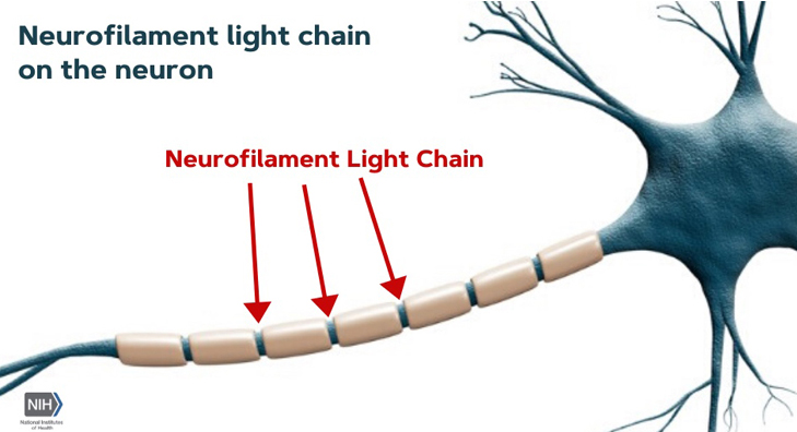 Neurofilament Light Chain on the Neuron 