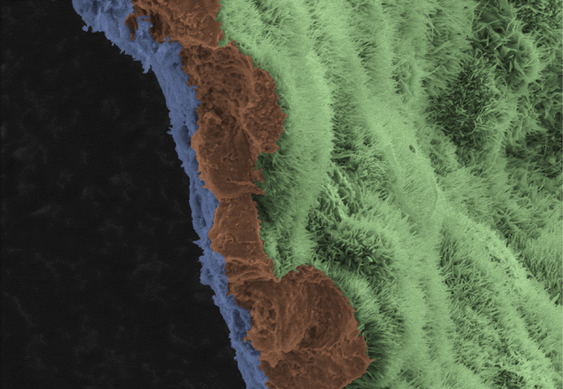 Scientific image of retinal pigment epithelium (RPE) on a biodegradable scaffold.