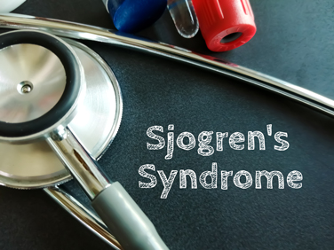 A medical stethoscope resting beside text that reads Sjogren's Syndrome