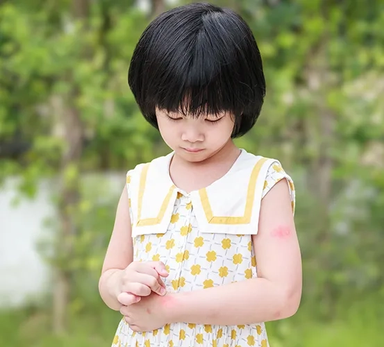 a child scratching an allergic reaction