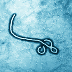 microscopic image of Ebola