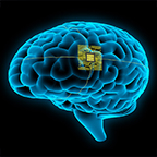 medical illustration of a human brain