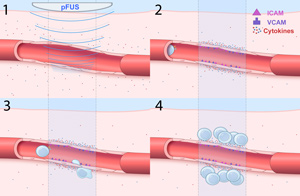 Medical illustration of transplanted stem cells.
