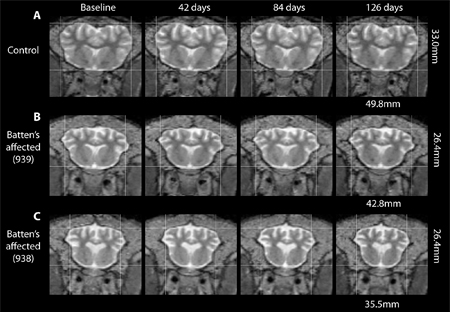 MRI image of the brain
