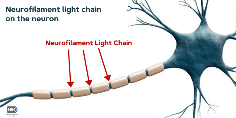 Neurofilament Light Chain on the Neuron