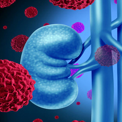 medical illustration of kidneys and blood cells
