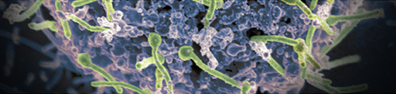 Ebola Continuing Research - ebola cells