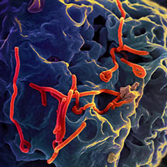 Electron micrograph of Ebola virus