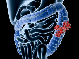 medical illustration of a stomach