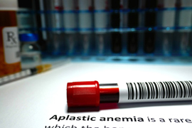 test tube above text that reads Aplastic Anemia