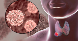 thyroid cancer cells medical illustration